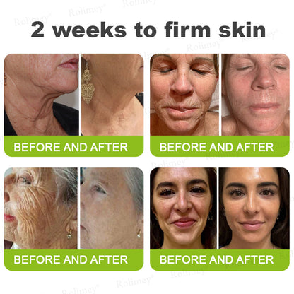 Made and shipped from the USA 💫Rolimey® Botox & Vita-A Retinol Shot Wrinkle-Lift Tightening cream - Last Day Promotion 70% OFF