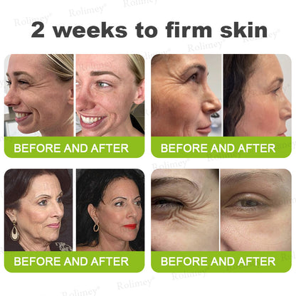 Made and shipped from the USA 💫Rolimey® Botox & Vita-A Retinol Shot Wrinkle-Lift Tightening cream - Last Day Promotion 70% OFF