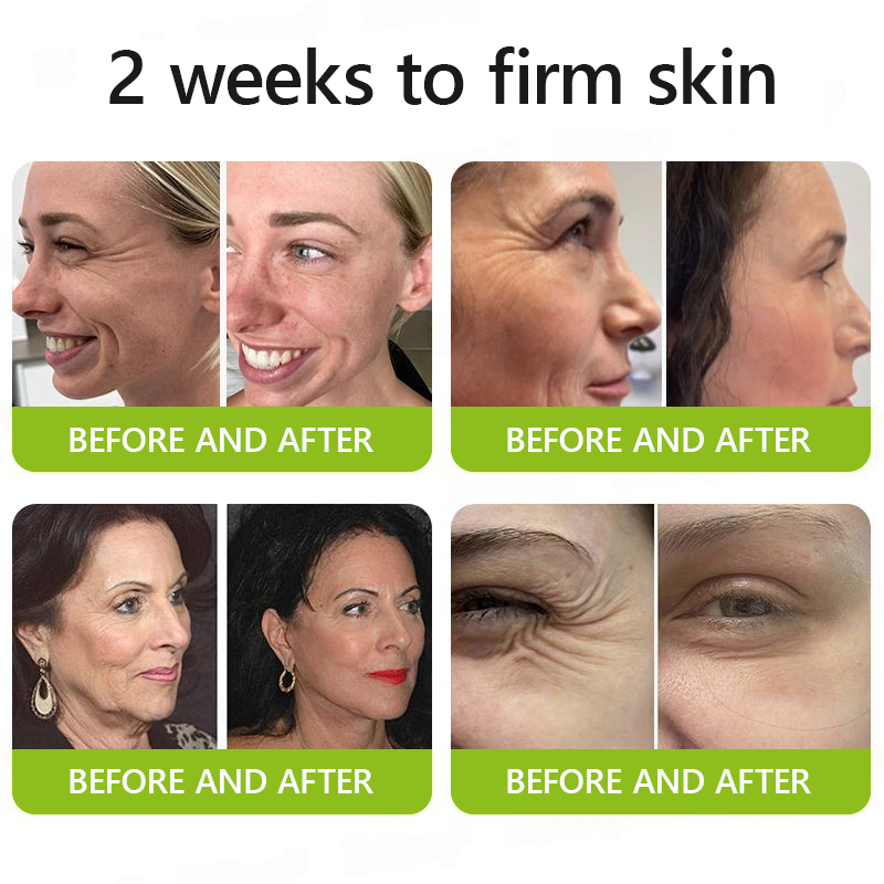𝑶𝒇𝒇𝒊𝒄𝒊𝒂𝒍 𝑺𝒕𝒐𝒓𝒆👍| Regain youthful skin nown 💫STDEI® BOTOX & VITA A RETINOL SHOT Wrinkle Lift Tightening Cream
