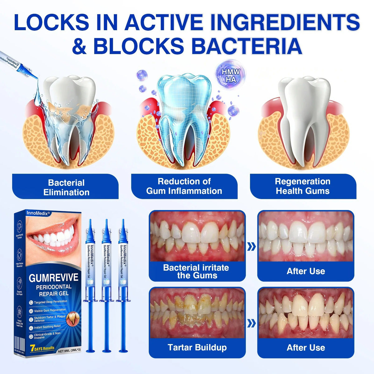 🇬🇧🏅🦷🛡️InnoMedix® GumRevive Periodontal Repair Gel